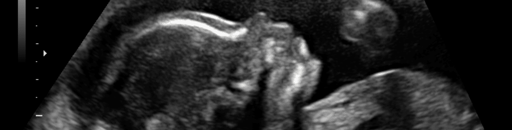 18-20-weeks-morphology-ultrasound-for-women